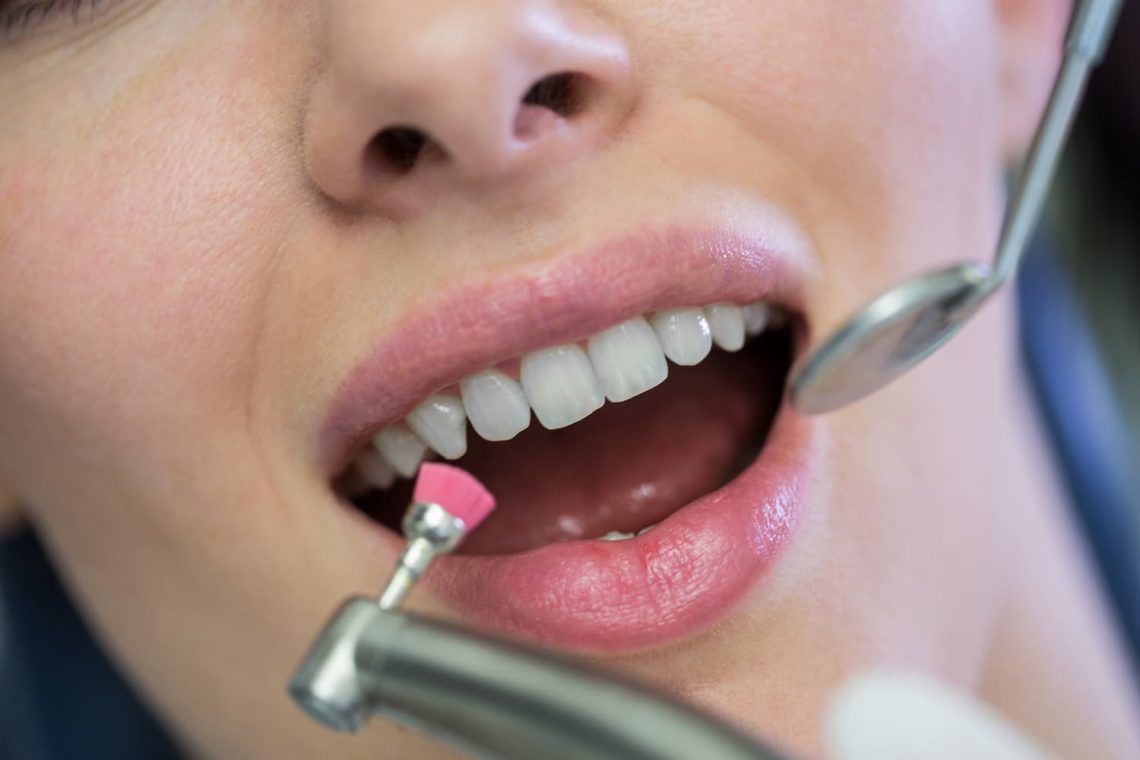 Cuidado dental integral, más allá de una simple limpieza