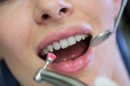Cuidado dental integral, más allá de una simple limpieza