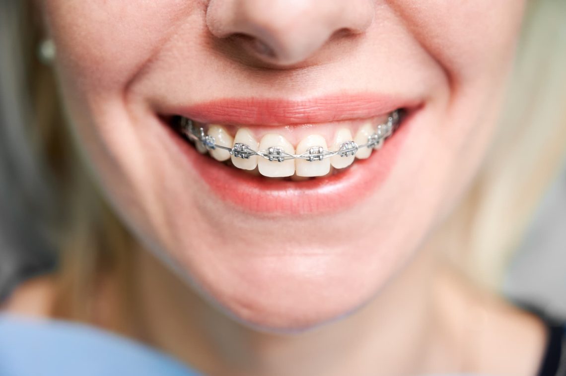 La ortodoncia, importante para una buena salud general